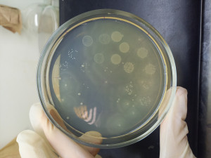 Топ-8 фактов о микробах, которые вас удивят